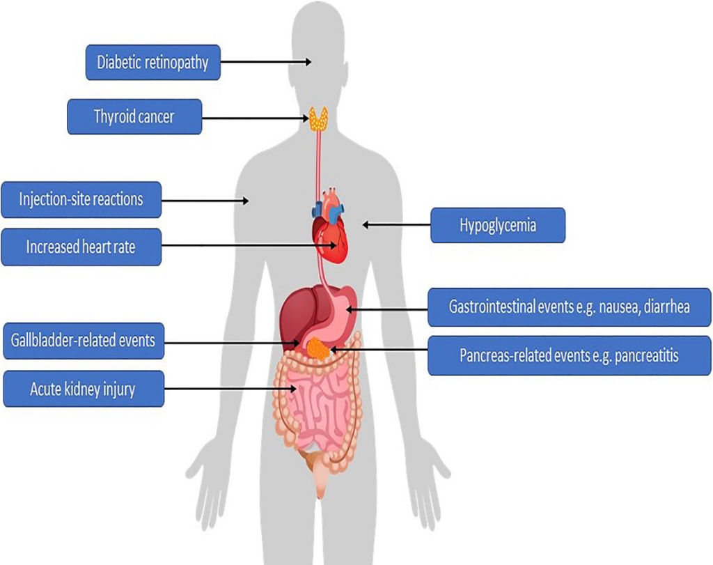 Семаглутид – препарат для борьбы с ожирением и терапии сахарного диабета