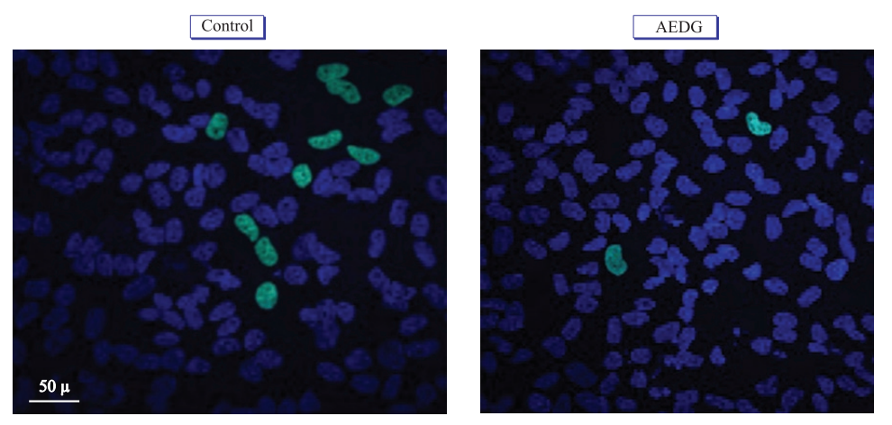 Пептид Эпиталон – передовой «антиэйджинг» препарат, средство для улучшения качества кожи, нормализации работы эндокринной системы, регуляции циркадных ритмов и повышения иммунитета.
